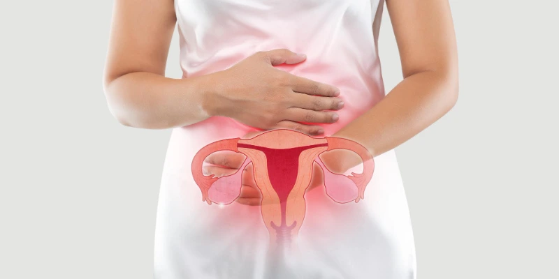 Does PCOS Always Lead To Infertility? Exploring Treatment Options